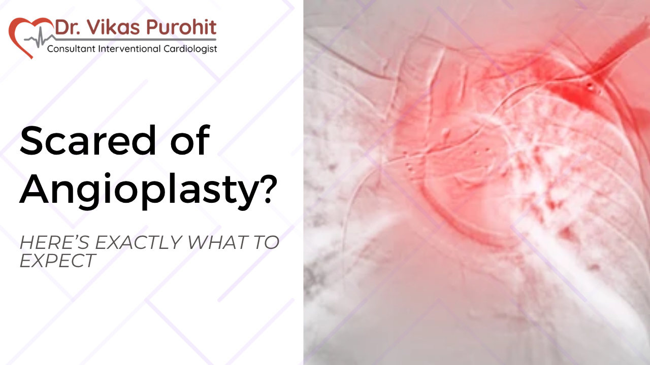 Scared of Angioplasty? Here’s Exactly What to Expect