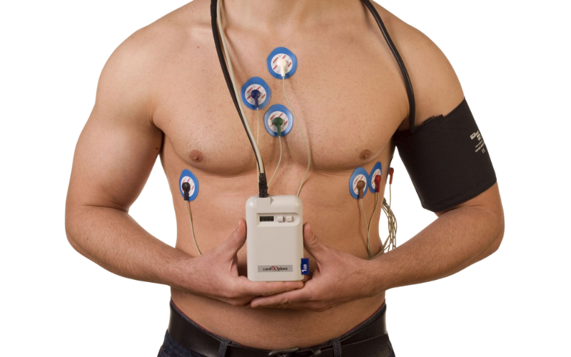 Holter Monitoring